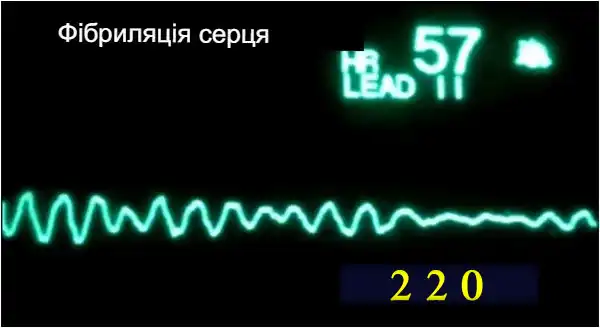 Попередження про небезпеку ураження струмом та наслідки для серця